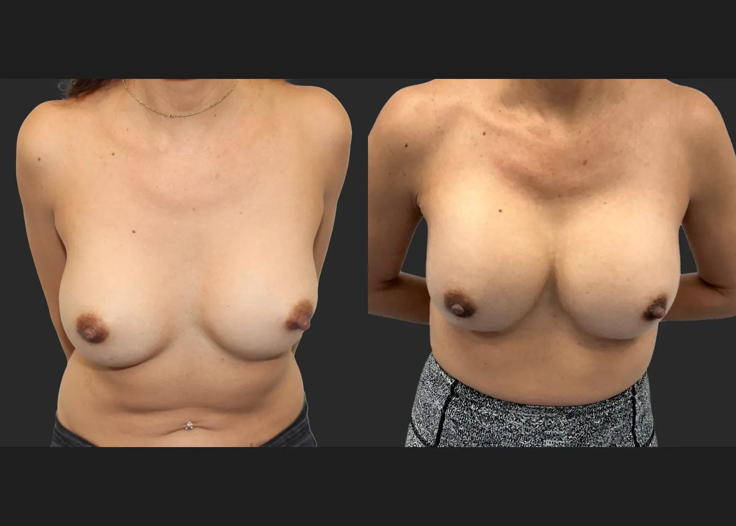 1 (3)