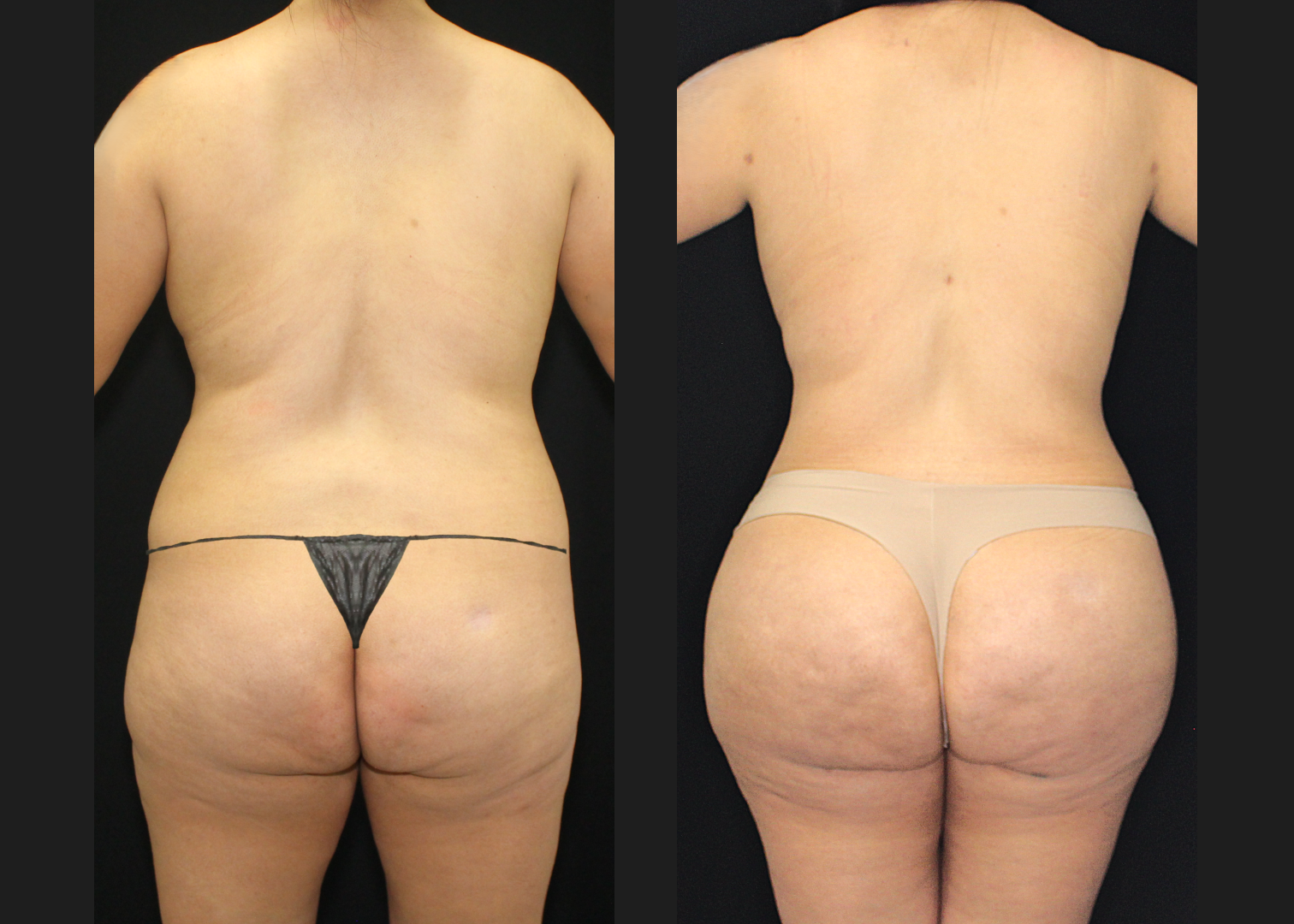 SCSC 12102025 before after back