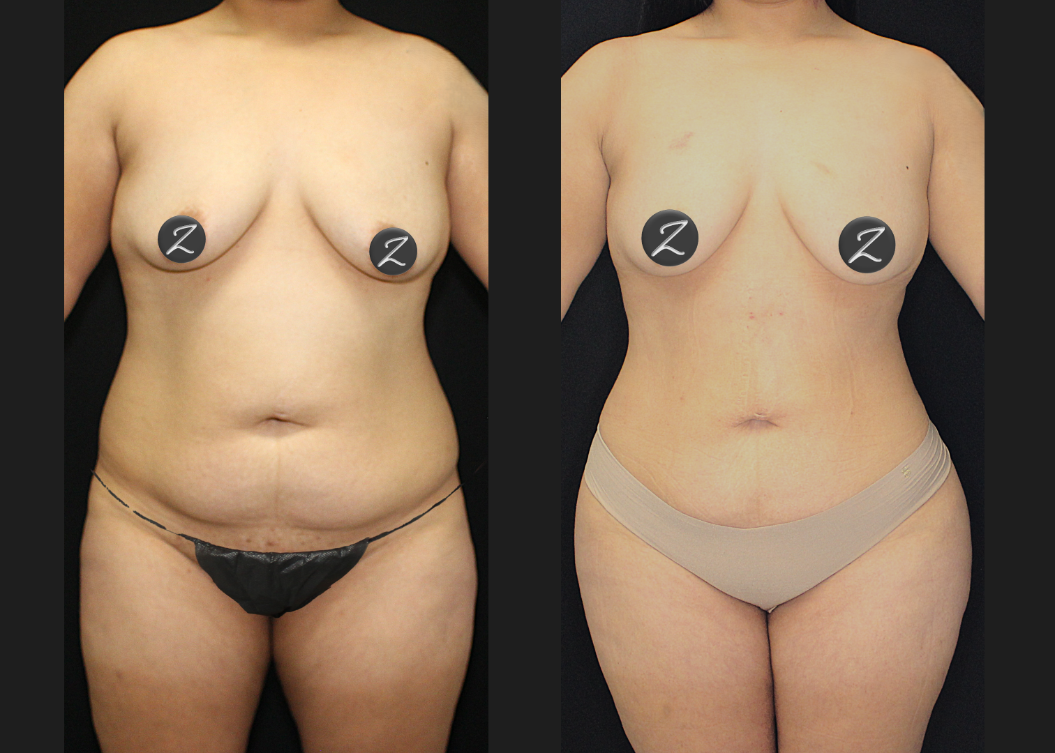 SCSC 12102025 before after front