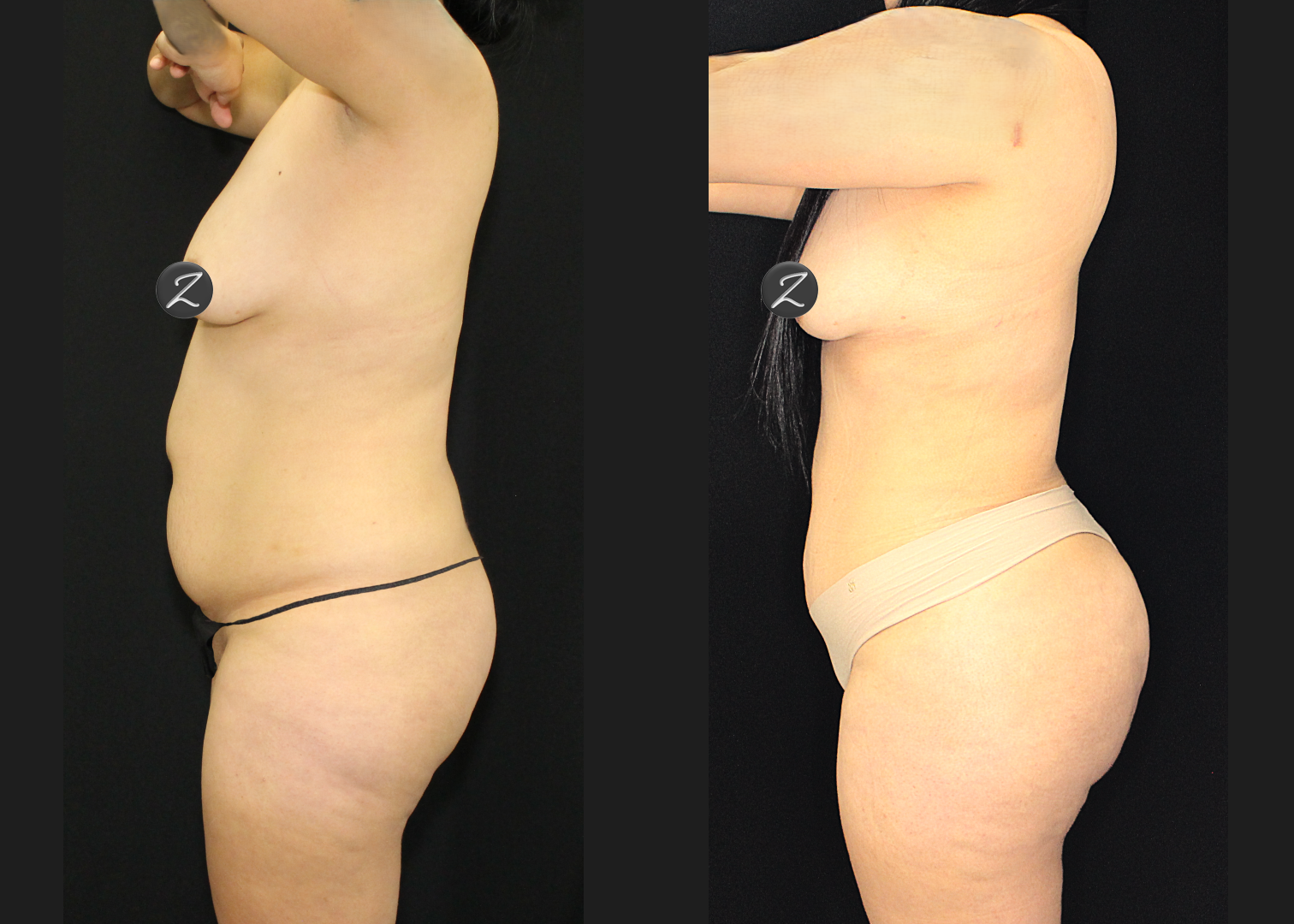 SCSC 12102025 before after left