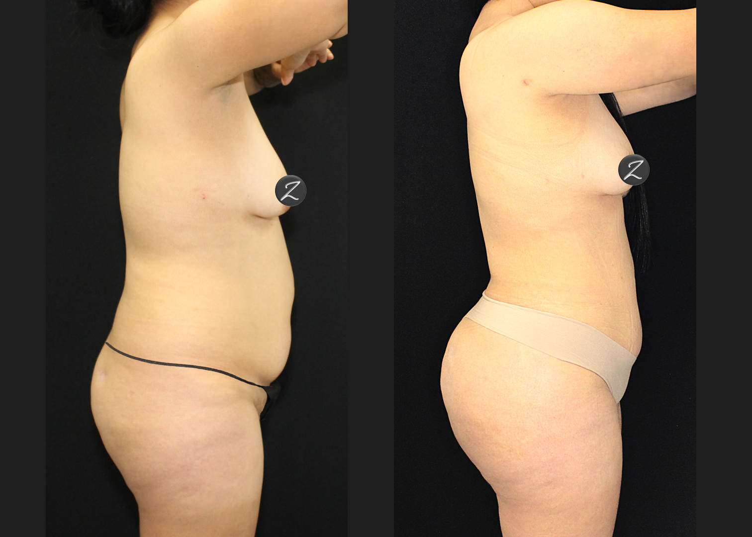 SCSC 12102025 before after right