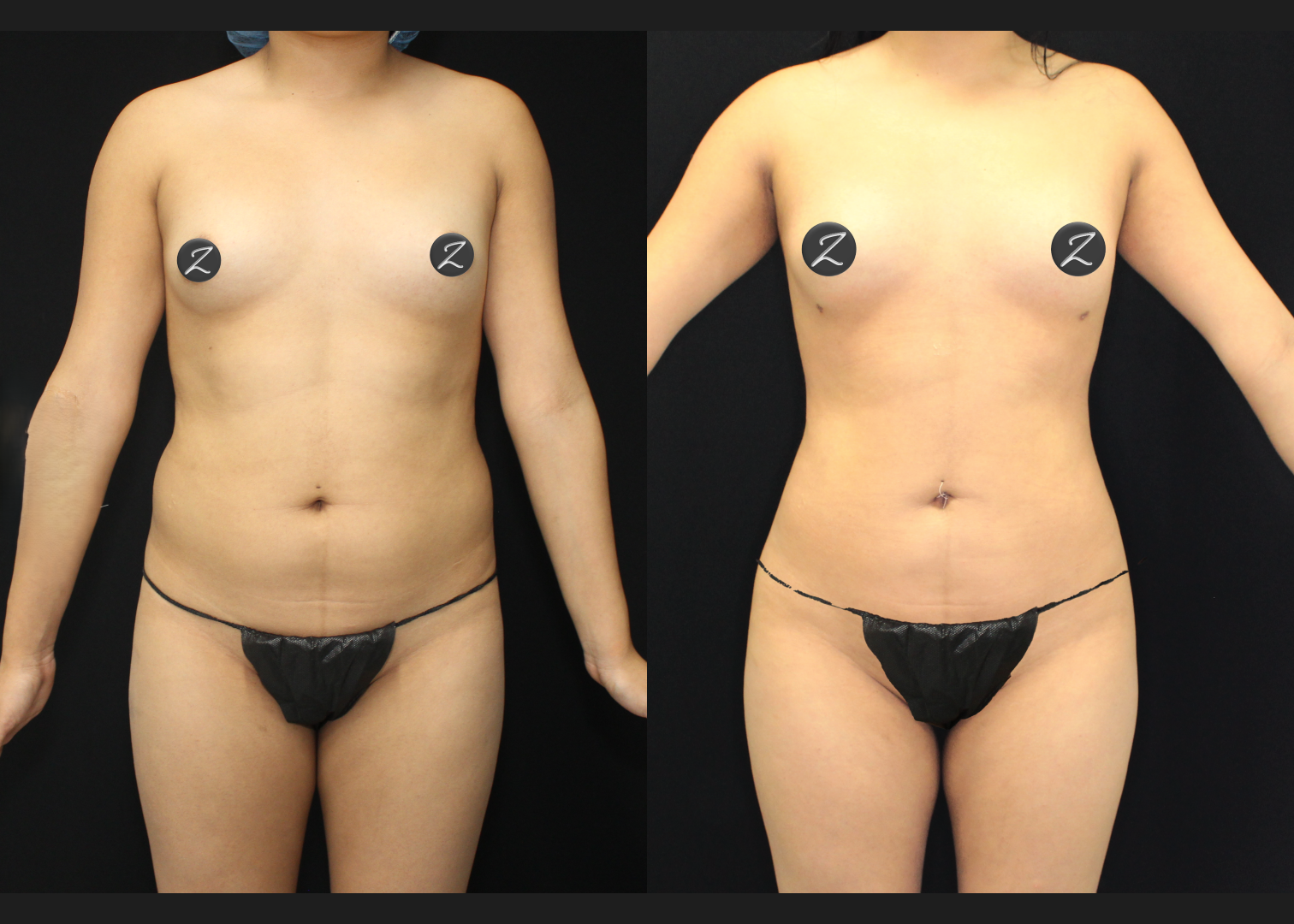 SCSC01212601 before after front