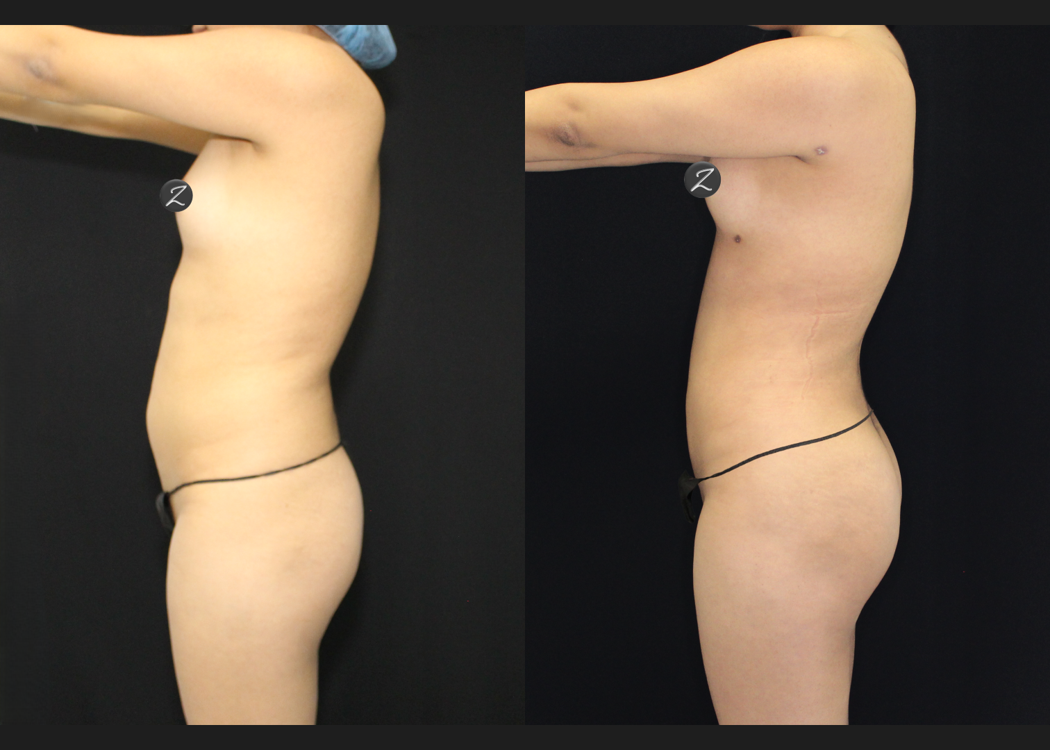 SCSC01212601 before after left