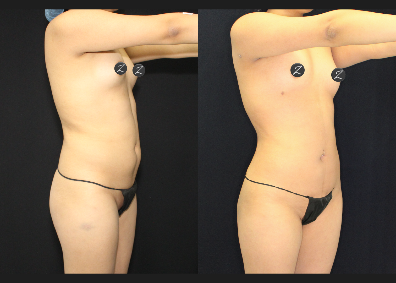 SCSC01212601 before after right oblique front